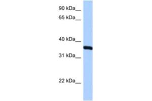 Western Blotting (WB) image for anti-Ribosomal Protein, Large, P0 (RPLP0) antibody (ABIN2462058) (RPLP0 antibody)