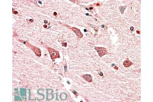 ABIN870635 (5µg/ml) staining of paraffin embedded Human Cerebral Cortex. (Myosin IB antibody  (Internal Region))