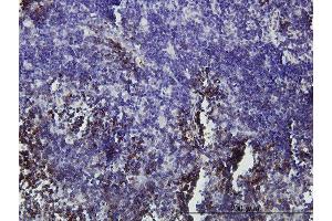 Immunoperoxidase of monoclonal antibody to GFI1 on formalin-fixed paraffin-embedded human lymph node. (GFI1 antibody  (AA 1-91))