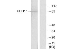Western blot analysis of extracts from Jurkat cells, using CDH11 antibody. (OB Cadherin antibody  (Internal Region))
