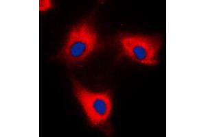 Immunofluorescent analysis of 14-3-3 theta/tau staining in HeLa cells. (14-3-3 theta antibody  (C-Term))
