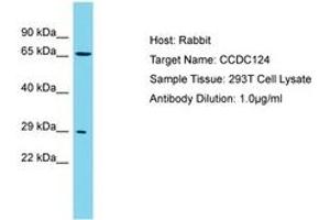 Image no. 1 for anti-Coiled-Coil Domain Containing 124 (CCDC124) (AA 46-95) antibody (ABIN6750742) (CCDC124 antibody  (AA 46-95))
