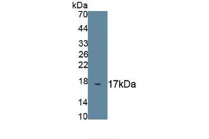 Detection of Recombinant MUC1, Human using Monoclonal Antibody to Mucin 1 (MUC1) (MUC1 antibody  (AA 1034-1151))