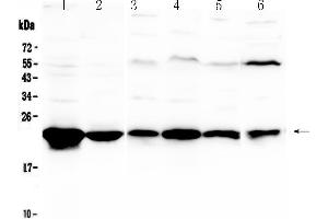 Western blot analysis of GST3 / GST pi using anti-GST3 / GST pi antibody . (GSTP1 antibody  (AA 2-210))