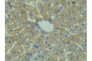 Detection of HMGCS in Mouse Liver Tissue using Polyclonal Antibody to Hydroxymethylglutaryl Coenzyme A Synthase (HMGCS) (HMGCS1 antibody  (AA 1-238))