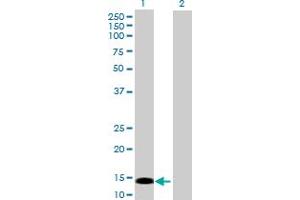 Western Blot analysis of PRKRIR expression in transfected 293T cell line by PRKRIR MaxPab polyclonal antibody. (PRKRIR antibody  (AA 1-150))