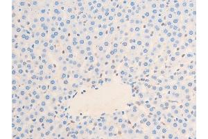 Immunohistochemistry (IHC) image for anti-Heat Shock Protein, alpha-Crystallin-Related, B6 (HSPB6) (pSer16) antibody (ABIN6256161)