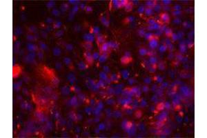 Immunofluorescence (IF) image for anti-Intercellular Adhesion Molecule 1 (ICAM1) antibody (ABIN2664766) (ICAM1 antibody)