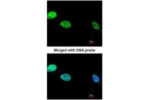 ICC/IF Image Immunofluorescence analysis of paraformaldehyde-fixed HeLa, using DNA Polymerase delta, catalytic subunit, antibody at 1:200 dilution. (POLD1 antibody  (Center))