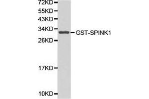 Western blot analysis of GST-SPINK1 recombinant protein using SPINK1 antibody.
