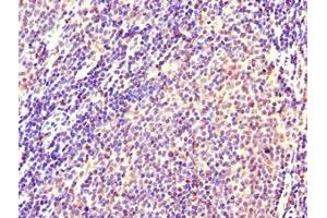 Immunohistochemistry of paraffin-embedded human lymph node tissue using ABIN7146099 at dilution of 1:100 (CXCR2 antibody  (AA 1-40))