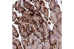 Immunohistochemical staining of human stomach with GDF6 polyclonal antibody  shows strong membranous and cytoplasmic positivity in glandular cells.