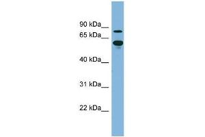 Human kidney; WB Suggested Anti-ABCF2 Antibody Titration: 0. (ABCF2 antibody  (N-Term))