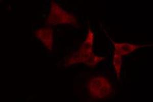 ABIN6272388 staining Hela cells by IF/ICC. (PHKB antibody  (Internal Region))