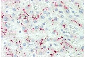 Human Liver: Formalin-Fixed, Paraffin-Embedded (FFPE) (IL12RB2 antibody  (AA 756-783))