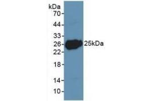 Detection of Recombinant LIF, Human using Polyclonal Antibody to Leukemia Inhibitory Factor (LIF) (LIF antibody  (AA 2-201))