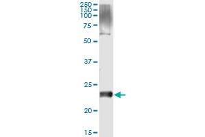 Immunoprecipitation of VSTM2L transfected lysate using anti-VSTM2L monoclonal antibody and Protein A Magnetic Bead , and immunoblotted with VSTM2L MaxPab rabbit polyclonal antibody. (VSTM2L antibody  (AA 25-204))
