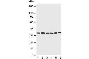 Western blot testing of Cdk4 antibody and Lane 1:  rat thymus;  2: HeLa;  3: MCF-7;  4: A549;  5: COLO320;  6: Jurkat cell lysate