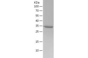 Western Blotting (WB) image for S100 Calcium Binding Protein A5 (S100A5) (AA 1-92) protein (His-IF2DI Tag) (ABIN7283177) (S100A5 Protein (AA 1-92) (His-IF2DI Tag))