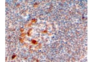 ABIN184577 (4µg/ml) staining of paraffin embedded Human Lymph Node. (ZCCHC11 antibody  (C-Term))