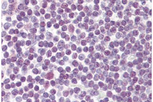 DDX18 antibody  (AA 20-70)