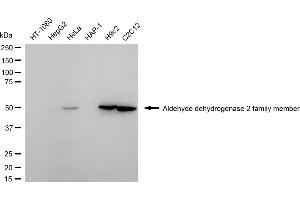 Western blotting analysis using aldehyde dehydrogenase 2 family member antibody (ABIN7797563).