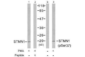 Image no. 2 for anti-Stathmin 1 (STMN1) (pSer37) antibody (ABIN196971) (Stathmin 1 antibody  (pSer37))