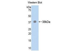 Western Blotting (WB) image for anti-Lactate Dehydrogenase A (LDHA) (AA 1-332) antibody (ABIN1078259) (Lactate Dehydrogenase A antibody  (AA 1-332))