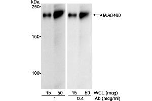 Western Blotting (WB) image for anti-Regulation of Nuclear Pre-mRNA Domain Containing 2 (RPRD2) (AA 1000-1050) antibody (ABIN7452562) (RPRD2 antibody  (AA 1000-1050))