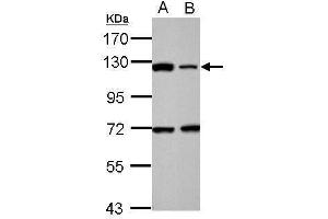 Western Blotting (WB) image for anti-Poly (ADP-Ribose) Polymerase 1 (PARP1) antibody (ABIN2854798)