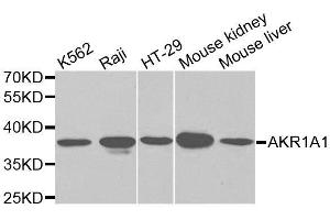 Western blot analysis of extracts of various cell lines, using AKR1A1 antibody. (AKR1A1 antibody  (AA 1-325))
