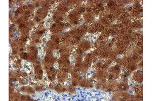 Image no. 2 for anti-NQO2 (NQO2) antibody (ABIN1499816) (NQO2 antibody)
