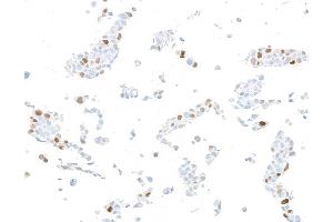 Immunocytochemistry (ICC) image for anti-Cyclin-Dependent Kinase Inhibitor 1A (p21, Cip1) (CDKN1A) (AA 100-150) antibody (ABIN7795765)
