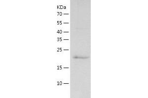Western Blotting (WB) image for RAP1A, Member of RAS Oncogene Family (RAP1A) (AA 1-181) protein (His tag) (ABIN7286722) (RAP1A Protein (AA 1-181) (His tag))