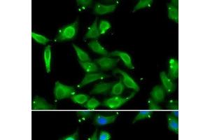 Immunofluorescence analysis of U2OS cells using GAMT Polyclonal Antibody (GAMT antibody)