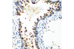 Immunohistochemistry of paraffin-embedded rat lung using MT-CO2 antibody. (COX2 antibody  (AA 100-200))