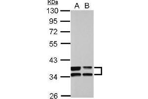 WB Image Sample (30 ug of whole cell lysate) A: A549 B: HCT116 10% SDS PAGE antibody diluted at 1:10000 (Annexin A3 antibody)