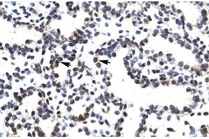 Human Lung; LHX3 antibody - middle region in Human Lung cells using Immunohistochemistry (LHX3 antibody  (Middle Region))