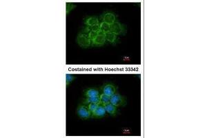 ICC/IF Image Immunofluorescence analysis of methanol-fixed A431, using CRK, antibody at 1:200 dilution. (Crk antibody  (Center))