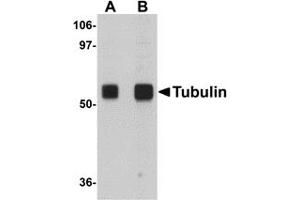 Western Blotting (WB) image for anti-alpha Tubulin (TUBA1) (N-Term) antibody (ABIN1031226) (alpha Tubulin antibody  (N-Term))