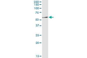 SLC11A1 monoclonal antibody (M01), clone 2G2. (SLC11A1 antibody  (AA 308-350))