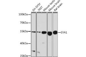 Western blot analysis of extracts of various cell lines, using EY Rabbit pAb (ABIN6135167, ABIN6140386, ABIN6225031 and ABIN6225033) at 1:1000 dilution.