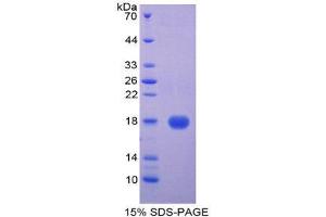 SDS-PAGE (SDS) image for Cystatin D (CST5) (AA 21-142) protein (His tag) (ABIN2124549)