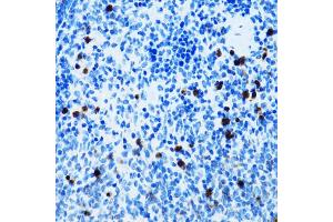 Immunohistochemistry of paraffin-embedded mouse spleen using SPN antibody (ABIN5973813) at dilution of 1/100 (40x lens). (CD43 antibody)
