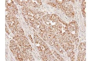 IHC-P Image Immunohistochemical analysis of paraffin-embedded N87 xenograft, using SUCLG1, antibody at 1:100 dilution. (SUCLG1 antibody)