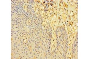 Immunohistochemistry of paraffin-embedded human tonsil tissue using ABIN7168070 at dilution of 1:100 (LMO2 antibody  (AA 1-100))