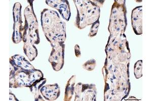 IHC analysis of Neurofibromin/NF1 using anti-Neurofibromin/NF1 antibody (ABIN7600197).