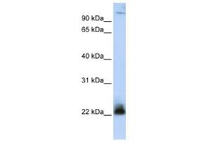 WB Suggested Anti-ITGB3BP Antibody Titration: 0. (ITGB3BP antibody  (N-Term))