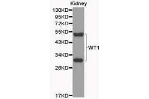 Western Blotting (WB) image for anti-Wilms Tumor 1 (WT1) antibody (ABIN1875356) (WT1 antibody)