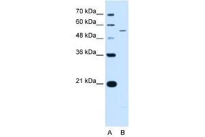KCNQ2 antibody used at 0. (KCNQ2 antibody  (N-Term))